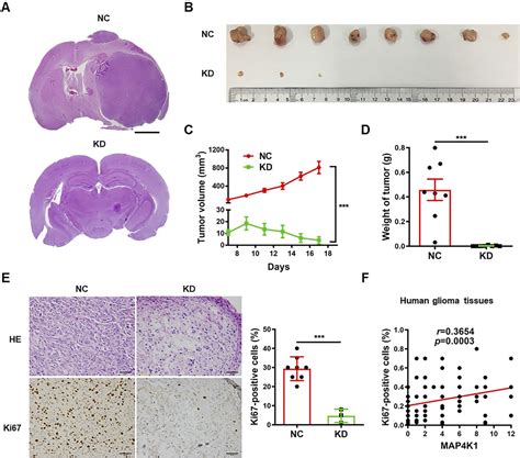 Glioblastoma Cellular Map4k1 Facilitates Tumor Growth And Disrupts T