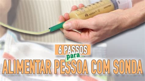 Como Alimentar Uma Pessoa Por Sonda Youtube