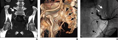 Figure 1062 From Angiographic Anatomy Of The Male Pelvic Arteries