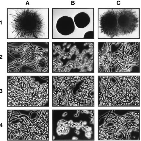 Colony Growth And Morphological Characteristics Of C Albicans Download Scientific Diagram