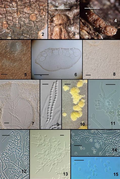 Hypocrea Flaviconidia Stromata Cells At The Stroma Surface