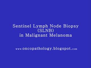 Melanoma Sentinel Lymph Node PPT