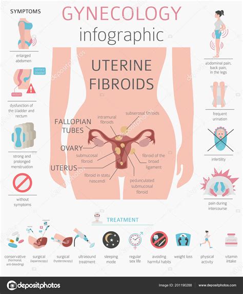 Uterine Fibroids Ginecological Medical Desease Women Infographic Vector