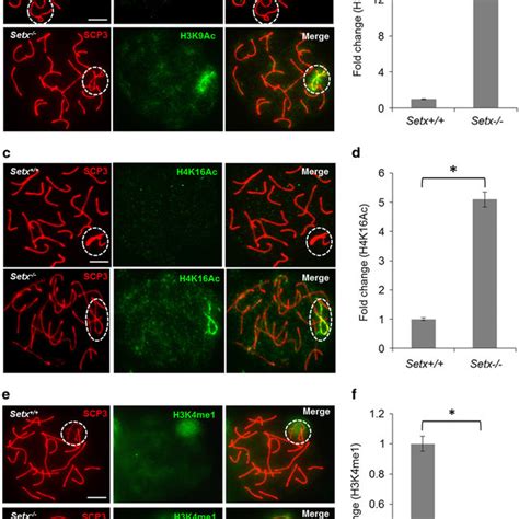 Senataxin Interacts With And Affects Chromodomain Helicase Binding Dna