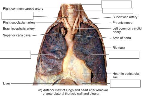 Human Anterior Thoracic Cavity Diagram Quizlet