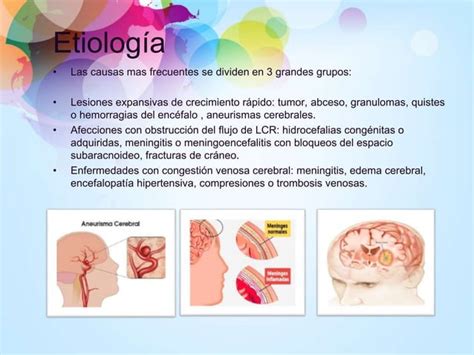 S Ndrome Men Ngeo Y S Ndrome De Hipertensi N Endocraneana Ppt