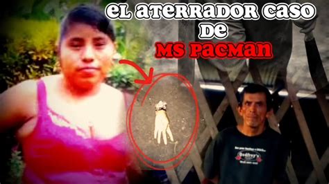 El caso de Alexandra icu chub más conocida como MS PACMAN YouTube