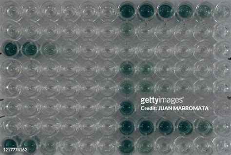 73 Antibody Assay Stock Photos, High-Res Pictures, and Images - Getty ...