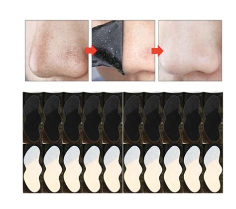 Blackhead Remover Strips Pore Acne Treatment Etsy