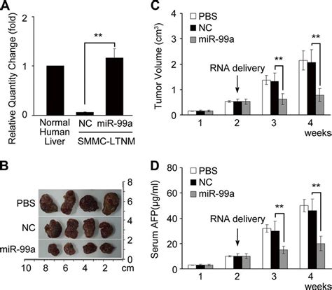 Mir A Suppresses Hcc Growth In Vivo A Real Time Qrt Pcr Analysis Of