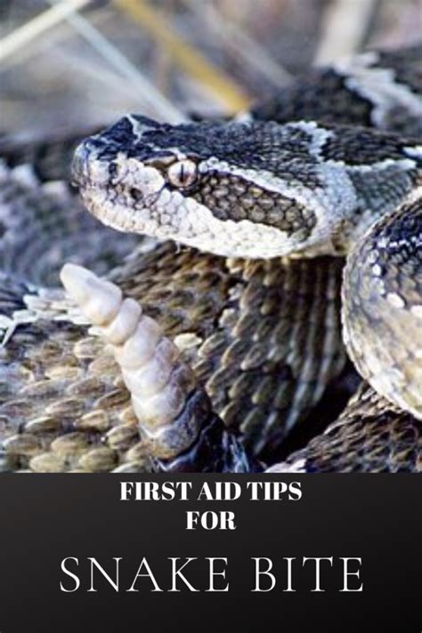 Simple Life-saving Tips On Surviving Snake Bite: Learn Some Essential Skills On Surviving Snake ...