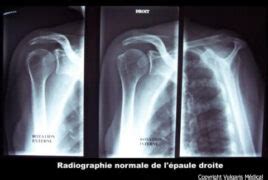 Paule Radiographie Normale Anatomie Photo Et Illustration