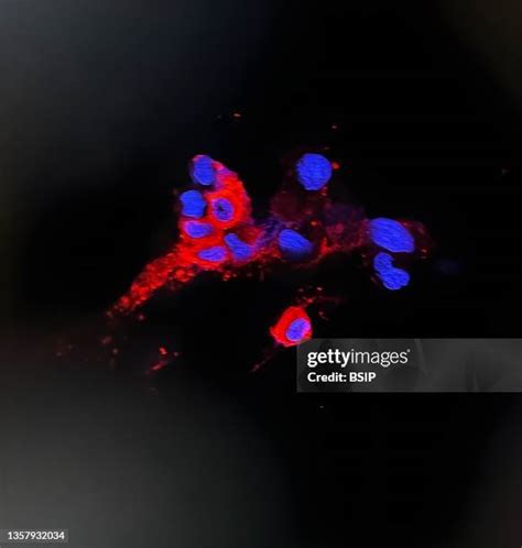 Immunofluorescence Photos And Premium High Res Pictures Getty Images