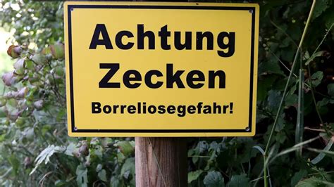 Borreliose Durch Zeckenstich Symptome Und Behandlung Deutschland