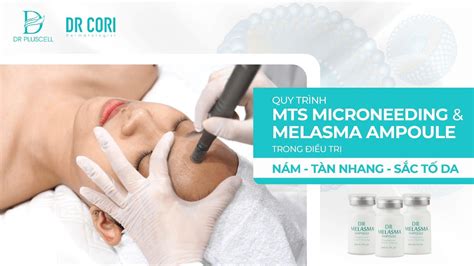 Quy trình MTS Melasma Ampoule đặc trị Nám Sắc tố da cho Spa Dr