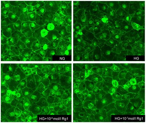 Ginsenoside Rg Attenuates High Glucoseinduced Endothelial Barrier