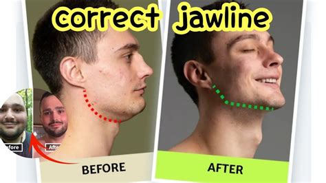 How To Get A More Defined Jawline In Only Mintue Youtube