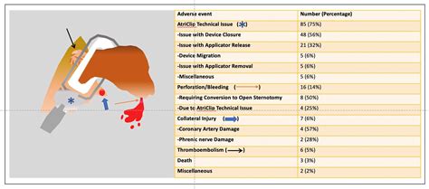 Po 671 06 Adverse Events Associated With The Atriclip Left Atrial