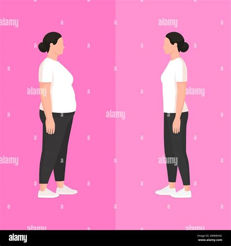 Overweight Vector Vectors Hi Res Stock Photography And Images Alamy