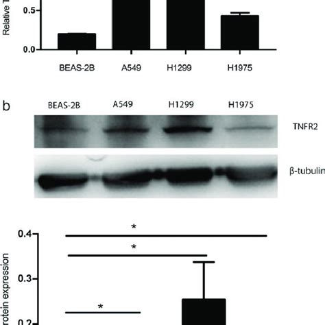 Expression Of Tumor Necrosis Factor Receptor Tnfr In Human