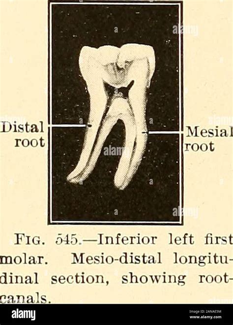 Principles And Practice Of Operative Dentistry Fig 544—a Superior