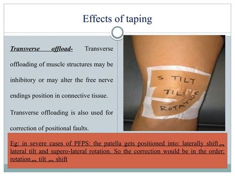 Mcconnell Taping Technique Ppt