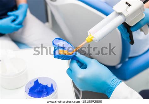 24 Lower Edentulous Dental Arch Stone Images Stock Photos 3d Objects