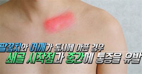 밤에 통증 심한 이유 낮에 괜찮았는데 왜 아플까 원인은