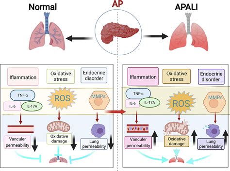 Frontiers The Mechanism Of Lung And Intestinal Injury In Acute