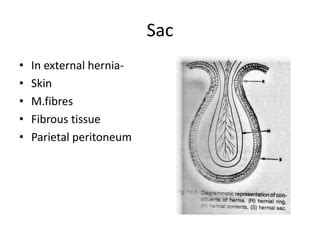 Hernia | PPT