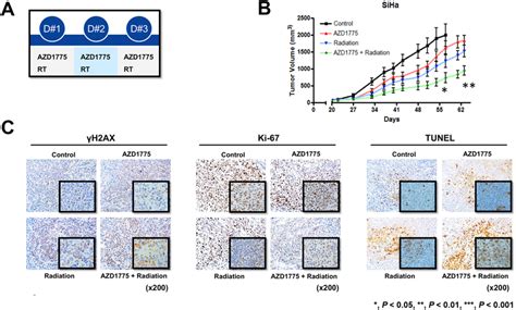 Combination Effect Of Azd And Ir In Siha Cell Xenografts Athymic