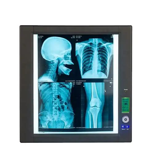 Hospital Double Led X Ray Viewer Light Box For Medical Film Or X Ray