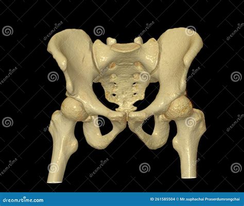 Ct Scan Of Pelvic Bone And Hip Joint 3d Rendering For Diagnosis