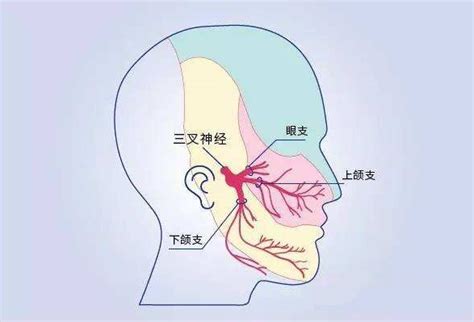 神外专家带你了解三叉神经痛的分类及症状表现 微医挂号网