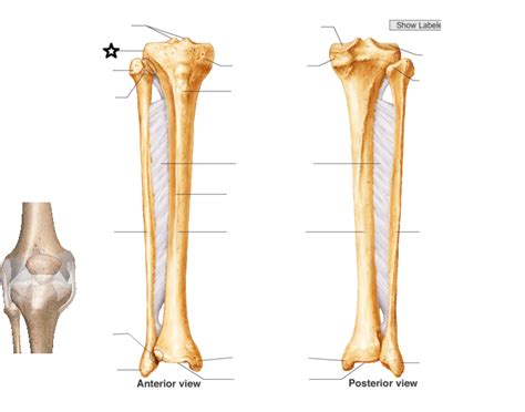 The Bony Landmarks Of The Tibia Fibula And The Patella Diagram Quizlet