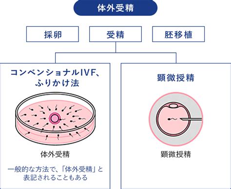 顕微受精 不妊治療は東京渋谷区のはらメディカルクリニック