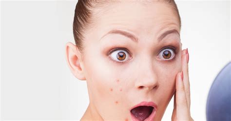 9 Letak Jerawat di Wajah yang Jadi Sinyal Tubuh Kurang Nutrisi - Hanya ...
