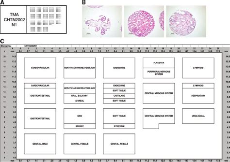 A Representative Tissue Microarray Tma Slide Consisting Of 06 Mm