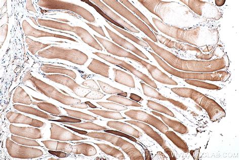 Ihceasy Myh7 Ready To Use Ihc Kit Khc0343 Proteintech