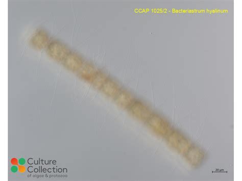 Bacteriastrum Hyalinum