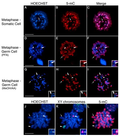 Comparison Of Global Dna Methylation Patterns In The Chromosomes Of