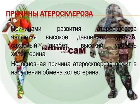 Болезни цивилизаций: атеросклероз - презентация онлайн