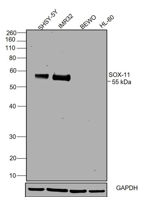 Sox11 Monoclonal Antibody Sox11 C1 14 9773 82