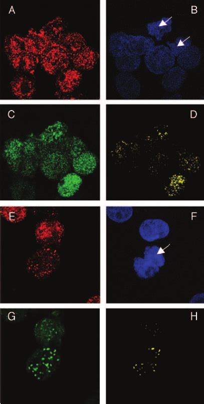 Colocalization Of Brd And Lana On Mitotic Chromosomes In Bjab Cells