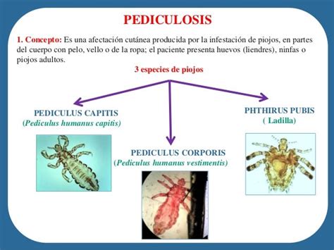 Pediculosis Y Sarna