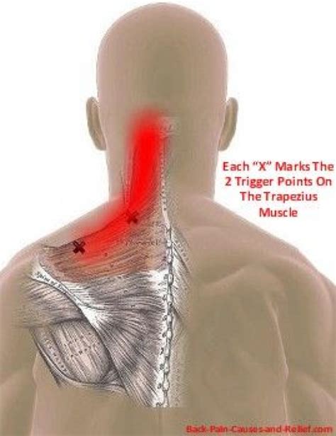 Can Trapped Wind Cause Back And Shoulder Pain At James Harper Blog