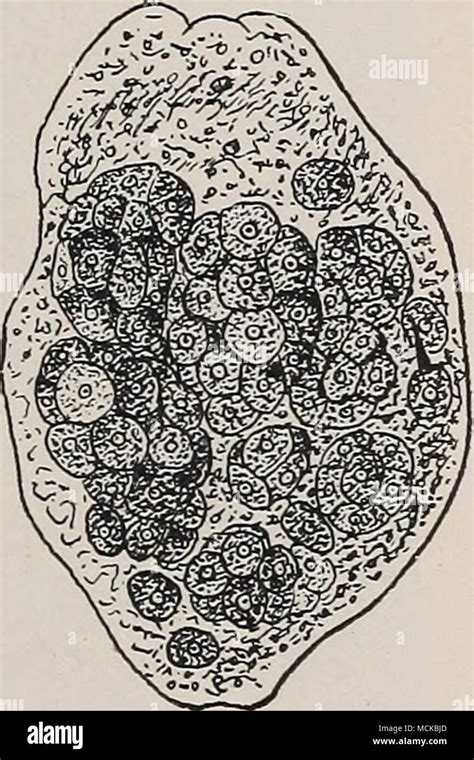 Fig 149—sporocyst Of The Common Hver Fluke Which Has De Veloped