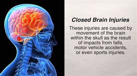 Types Of Traumatic Brain Injuries Youtube