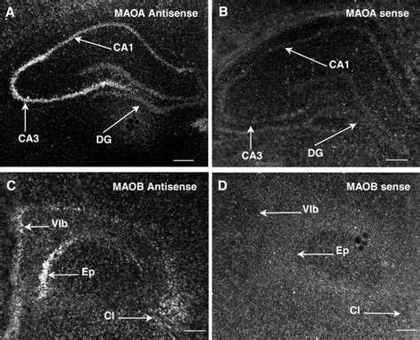 Maoa And Maob Mrna Expression In The Telencephalon Maoa A B And Maob