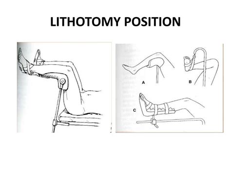 Patient Positioning And Anaesthesia Ppt Ppt